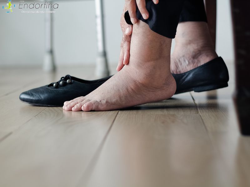 Zastój limfy i opuchnięte nogi. Jak domowe sposoby i profesjonalne wsparcie przynoszą ulgę?